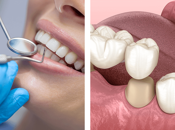 Dental Equipment, Dental Bridge, Patient getting a checkup