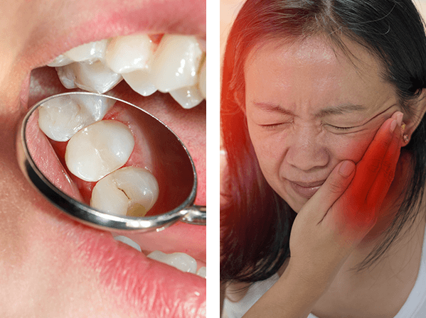 Dental Instrument, Woman having a tooth ache
