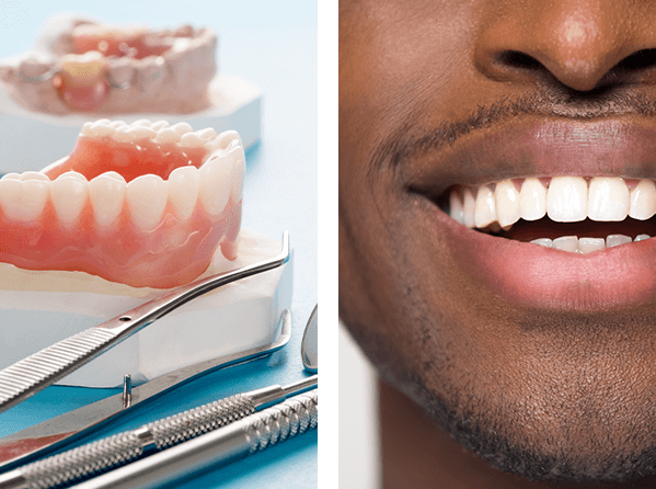 Denture for teeth, Smiling man