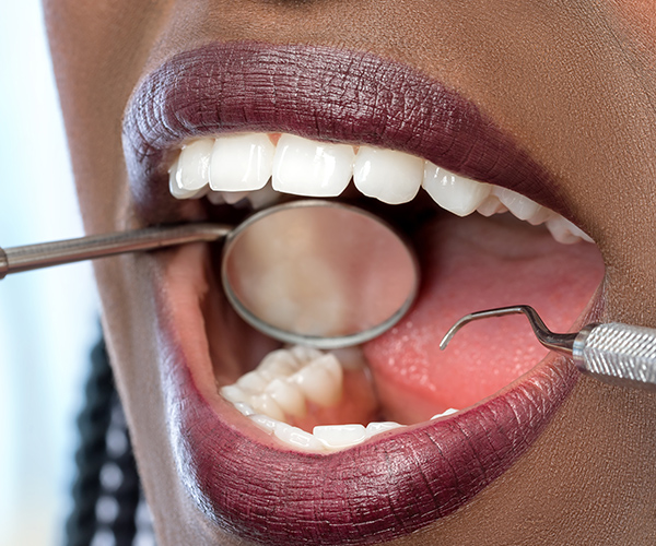 Open mouth, Hand of the dentist doing a checkup on someone's teeth