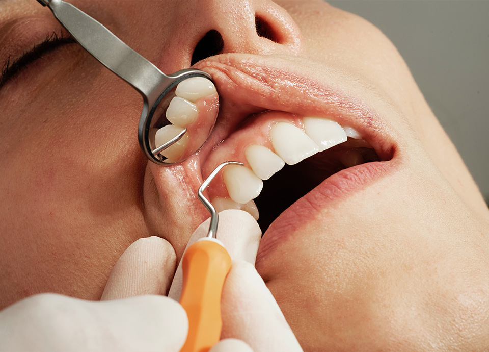Patient getting a gum checkup, Hand of dentist using dental instruments to check the patients gum