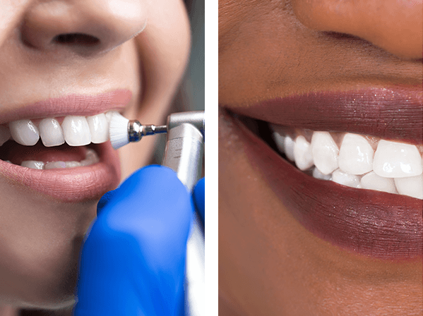 Patient getting her teeth cleaned, Person smiling