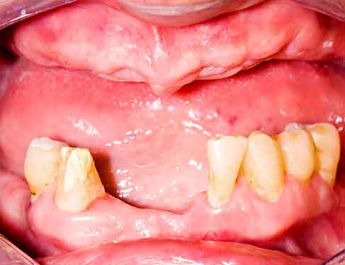 Teeth Before 01-2 Teeth Before