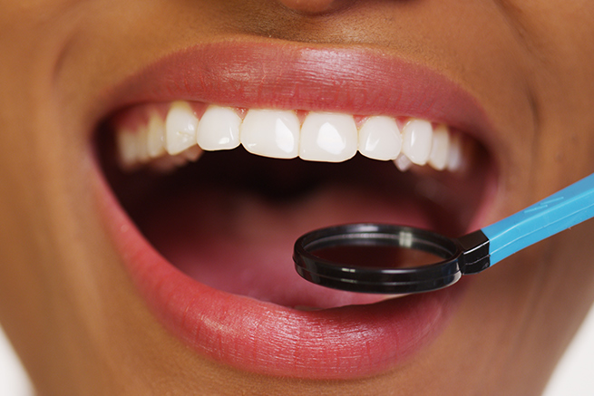 Teeth of person being checkup using dentist dental instrument, Open mouth